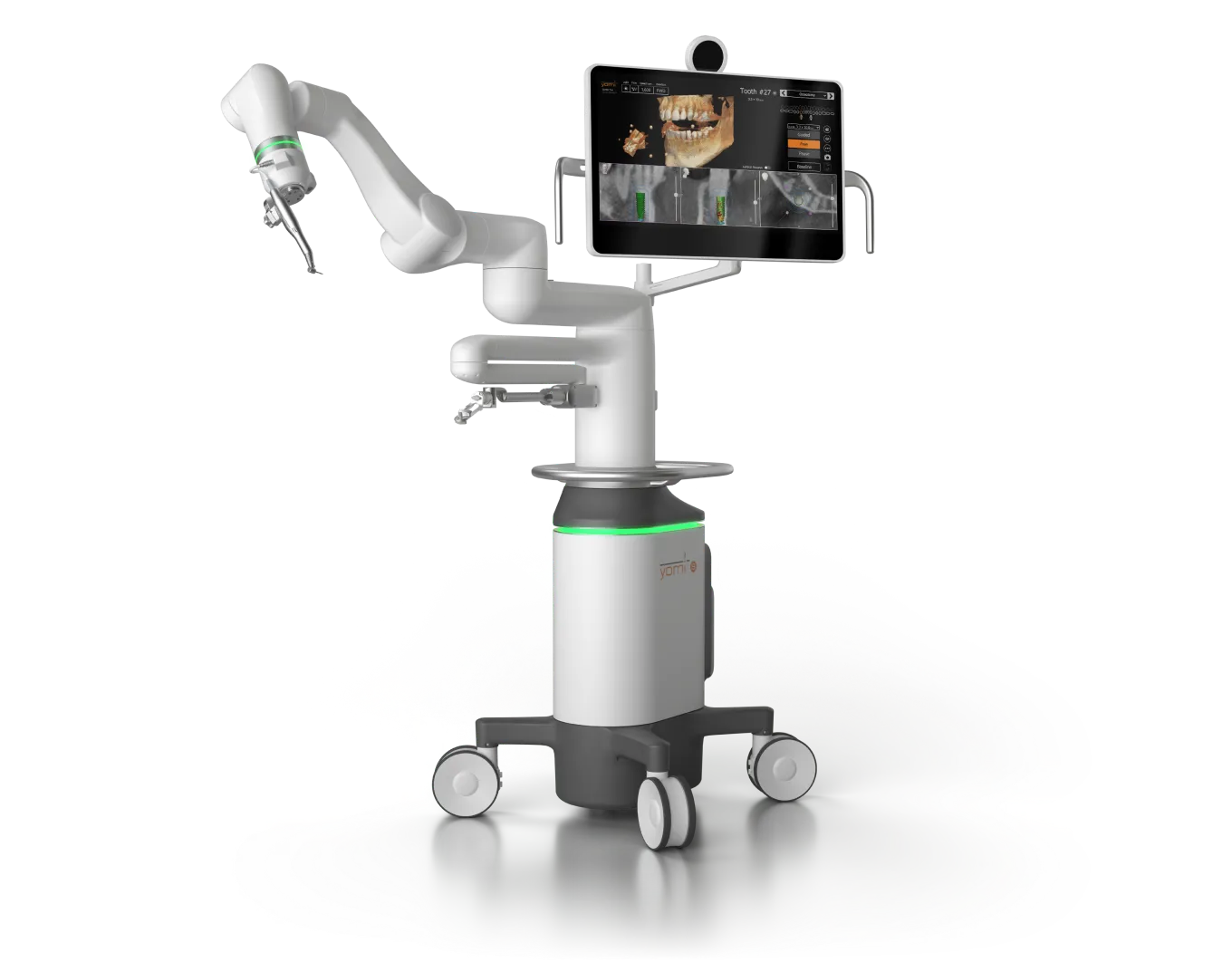 Yomi robotic dental surgery system